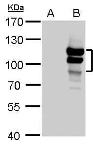 Western Blot L3MBTL1 Antibody