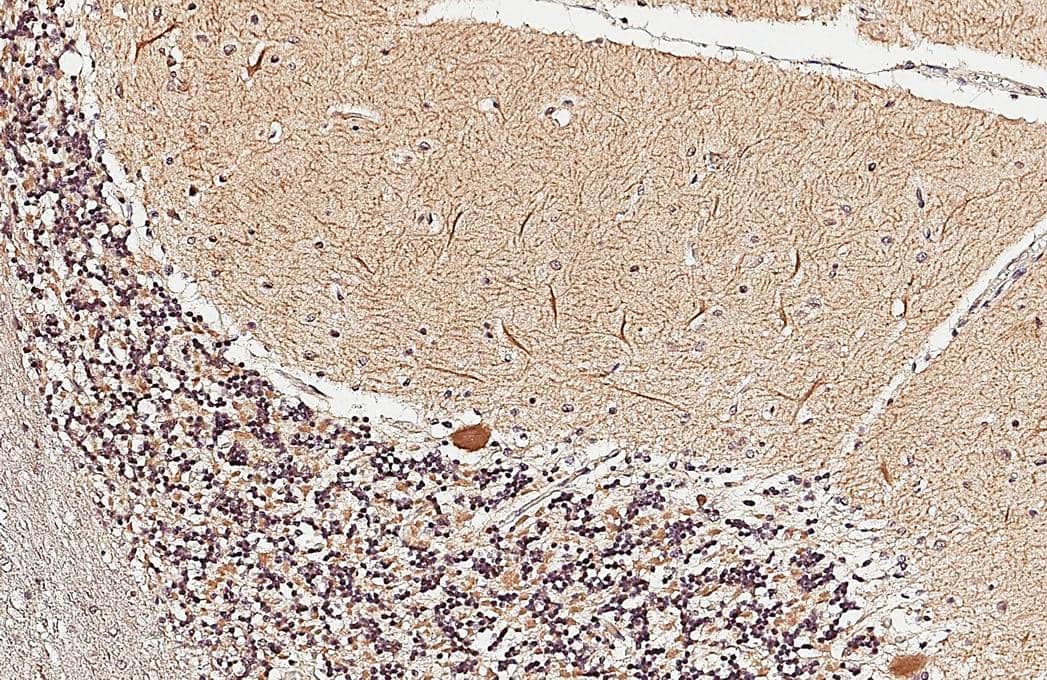 <b>Orthogonal Strategies Validation. </b>ST3 beta-Gal alpha-2,3-Sialyltransferase 2/ST3GAL2 antibody [N2C3] detects ST3 beta-Gal alpha-2,3-Sialyltransferase 2/ST3GAL2 protein by immunohistochemical analysis.Sample: Paraffin-embedded human cerebellum.ST3 beta-Gal alpha-2,3-Sialyltransferase 2/ST3GAL2 stained by ST3 beta-Gal alpha-2,3-Sialyltransferase 2/ST3GAL2 antibody [N2C3] (NBP1-32451) diluted at 1:500.Antigen Retrieval: Citrate buffer, pH 6.0, 15 min 