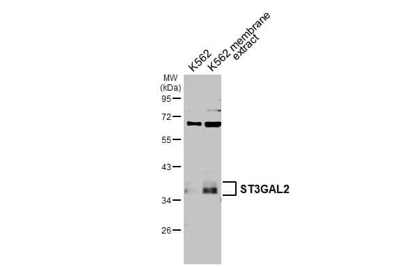 K562 whole cell and membrane extracts (30 ug) were separated by 10% SDS-PAGE, and the membrane was blotted with ST3 beta-Gal alpha-2,3-Sialyltransferase 2/ST3GAL2 antibody [N2C3] (NBP1-32451) diluted at 1:1000. The HRP-conjugated anti-rabbit IgG antibody was used to detect the primary antibody. 