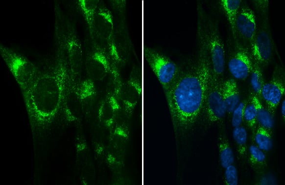 Immunocytochemistry/ Immunofluorescence: Albumin Antibody [NBP1-32458] - Immunofluorescence localization of TNF-alpha , IL-1 beta  & IL-6 in the liver tissue of animals treated with ConA or ConA + hVNS. a–c Representative immunofluorescence images of TNF-alpha , IL-1 beta , & IL-6 that were merged with CD11b. Signal intensities of TNF-alpha , IL-1 beta , & IL-6 from 4 to 6 images were averaged per each animal & compared among experimental groups (n = 3 independent experiments). One-way ANOVA with Tukey post hoc is shown. *p Sample: PG-4 cells were fixed in 4% paraformaldehyde at RT for 15 min.Green: Albumin stained by Albumin antibody (NBP1-32458) diluted at 1:500.Blue: Hoechst 33342 staining.