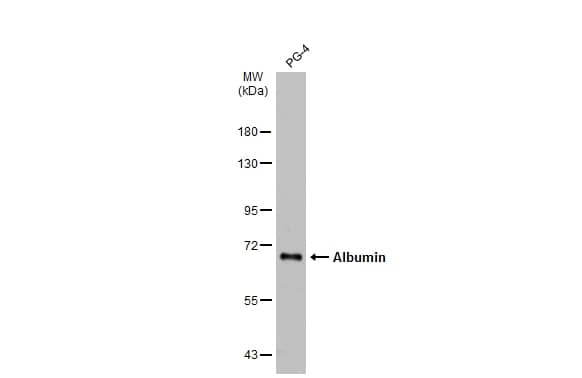 Western Blot: Albumin Antibody [NBP1-32458] - PG-4 whole cell extract (30 ug) was separated by 7.5% SDS-PAGE, and the membrane was blotted with Albumin antibody (NBP1-32458) diluted at 1:1000. The HRP-conjugated anti-rabbit IgG antibody  was used to detect the primary antibody.