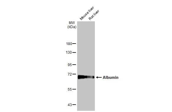 Western Blot: Albumin Antibody [NBP1-32458] - Various tissue extracts (50 ug) were separated by 7.5% SDS-PAGE, and the membrane was blotted with Albumin antibody (NBP1-32458) diluted at 1:1000. The HRP-conjugated anti-rabbit IgG antibody  was used to detect the primary antibody.