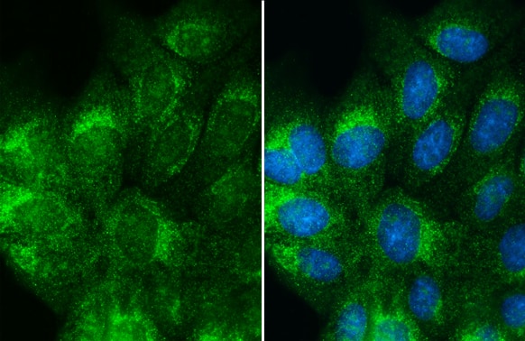 Immunocytochemistry/ Immunofluorescence: Albumin Antibody [NBP1-32458] - Albumin antibody detects Albumin protein at cytoplasm by immunofluorescent analysis.Sample: MDCK cells were fixed in 4% paraformaldehyde at RT for 15 min.Green: Albumin stained by Albumin antibody (NBP1-32458) diluted at 1:500.Blue: Hoechst 33342 staining.