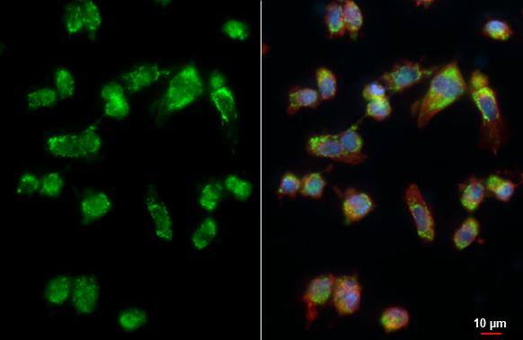 PEX26 antibody detects PEX26 protein by immunofluorescent analysis.Sample: HT-1080 cells were fixed in ice-cold MeOH for 5 min.Green: PEX26 stained by PEX26 antibody (NBP1-32743) diluted at 1:500.Red: alpha Tubulin, a cytoskeleton marker, stained by alpha Tubulin antibody [GT114]  diluted at 1:1000.Blue: Fluoroshield with DAPI . 