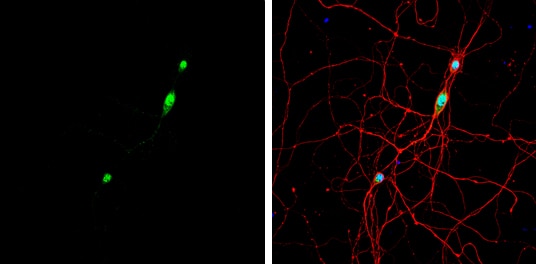 Immunocytochemistry/ Immunofluorescence: Nova1 Antibody [NBP1-32459] - Nova1 antibody detects Nova1 protein by immunofluorescent analysis.Sample: DIV9 rat E18 primary hippocampal neuron cells were fixed in 4% paraformaldehyde at RT for 15 min.Green: Nova1 stained by Nova1 antibody (NBP1-32459) diluted at 1:500.Red: beta Tubulin 3/ Tuj1, stained by beta Tubulin 3/ Tuj1 antibody [GT11710]  diluted at 1:500.Blue: Fluoroshield with DAPI .