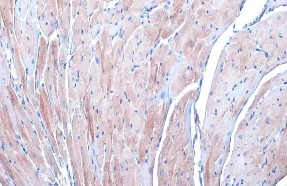 Immunohistochemistry-Paraffin: Alpha Actinin 2 Antibody [NBP1-32462] - Alpha Actinin 2 antibody [N1N3] detects Alpha Actinin 2 protein at cytoplasm by immunohistochemical analysis.Sample: Paraffin-embedded mouse heart.Alpha Actinin 2 stained by Alpha Actinin 2 antibody [N1N3] (NBP1-32462) diluted at 1:500.Antigen Retrieval: Citrate buffer, pH 6.0, 15 min