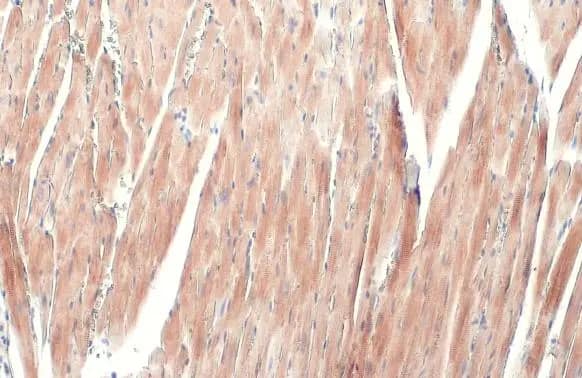 Immunohistochemistry-Paraffin: Alpha Actinin 2 Antibody [NBP1-32462] - Alpha Actinin 2 antibody [N1N3] detects Alpha Actinin 2 protein at cytoplasm by immunohistochemical analysis.Sample: Paraffin-embedded mouse heart.Alpha Actinin 2 stained by Alpha Actinin 2 antibody [N1N3] (NBP1-32462) diluted at 1:500.Antigen Retrieval: Citrate buffer, pH 6.0, 15 min