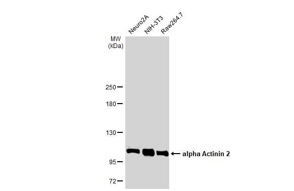 Western Blot: Alpha Actinin 2 Antibody [NBP1-32462] - Various whole cell extracts (30 ug) were separated by 5% SDS-PAGE, and the membrane was blotted with Alpha Actinin 2 antibody [N1N3] (NBP1-32462) diluted at 1:1000. The HRP-conjugated anti-rabbit IgG antibody  was used to detect the primary antibody.