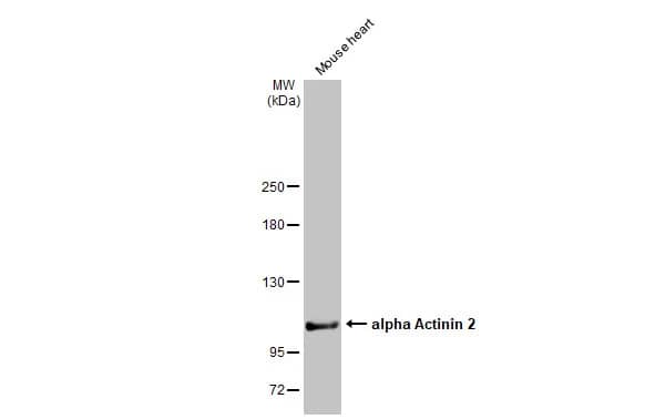 Western Blot: Alpha Actinin 2 Antibody [NBP1-32462] - Mouse tissue extract (50 ug) was separated by 5% SDS-PAGE, and the membrane was blotted with Alpha Actinin 2 antibody [N1N3] (NBP1-32462) diluted at 1:100000. The HRP-conjugated anti-rabbit IgG antibody  was used to detect the primary antibody.