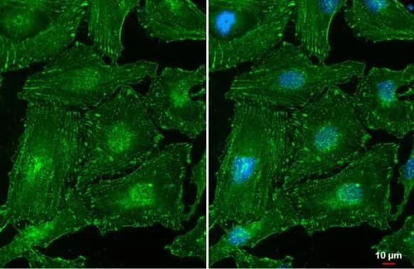 Immunocytochemistry/ Immunofluorescence: Alpha Actinin 2 Antibody [NBP1-32462] - Alpha Actinin 2 antibody [N1N3] detects Alpha Actinin 2 protein at cytoskeleton by immunofluorescent analysis.Sample: HeLa cells were fixed in ice-cold MeOH for 5 min.Green: Alpha Actinin 2 stained by Alpha Actinin 2 antibody [N1N3] (NBP1-32462) diluted at 1:500.Blue: Fluoroshield with DAPI .