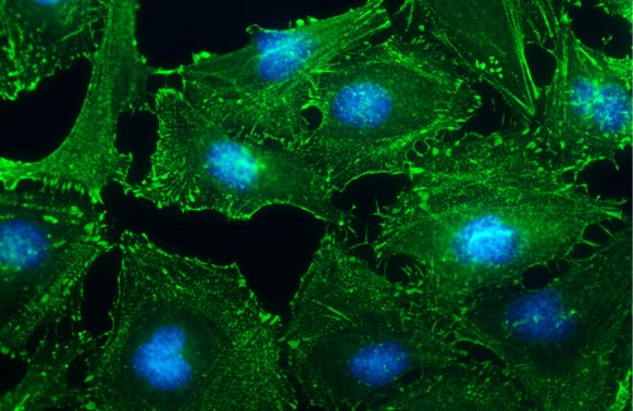 Immunocytochemistry/ Immunofluorescence: Alpha Actinin 2 Antibody [NBP1-32462] - Alpha Actinin 2 antibody [N1N3] detects Alpha Actinin 2 protein at cytoskeleton by immunofluorescent analysis.Sample: HeLa cells were fixed in ice-cold MeOH for 5 min.Green: Alpha Actinin 2 stained by Alpha Actinin 2 antibody [N1N3] (NBP1-32462) diluted at 1:500.Blue: Hoechst 33342 staining.