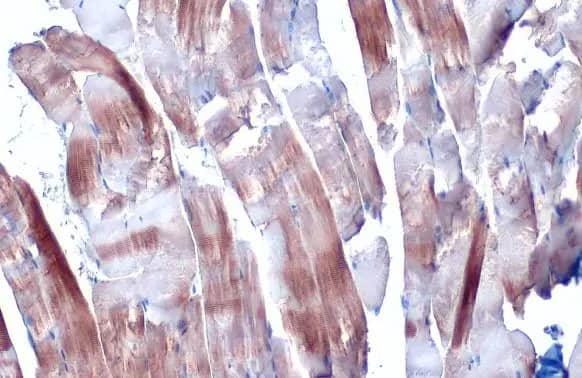 Immunohistochemistry-Paraffin: Alpha Actinin 2 Antibody [NBP1-32462] - Alpha Actinin 2 antibody [N1N3] detects Alpha Actinin 2 protein at cytoplasm by immunohistochemical analysis.Sample: Paraffin-embedded mouse muscle.Alpha Actinin 2 stained by Alpha Actinin 2 antibody [N1N3] (NBP1-32462) diluted at 1:500.Antigen Retrieval: Citrate buffer, pH 6.0, 15 min