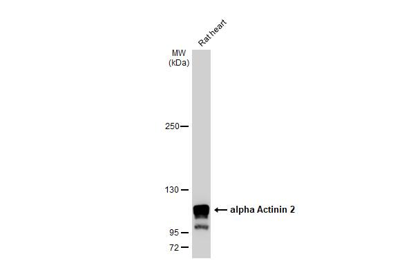 Western Blot: Alpha Actinin 2 Antibody [NBP1-32462] - Rat tissue extract (50 ug) was separated by 5% SDS-PAGE, and the membrane was blotted with Alpha Actinin 2 antibody [N1N3] (NBP1-32462) diluted at 1:20000. The HRP-conjugated anti-rabbit IgG antibody  was used to detect the primary antibody.