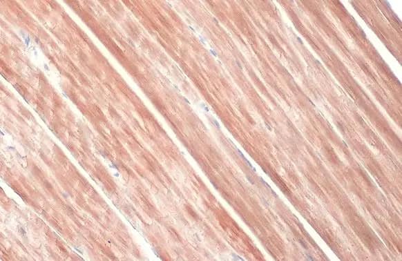 Immunohistochemistry-Paraffin: Alpha Actinin 2 Antibody [NBP1-32462] - Alpha Actinin 2 antibody [N1N3] detects Alpha Actinin 2 protein at cytoplasm by immunohistochemical analysis.Sample: Paraffin-embedded mouse muscle.Alpha Actinin 2 stained by Alpha Actinin 2 antibody [N1N3] (NBP1-32462) diluted at 1:500.Antigen Retrieval: Citrate buffer, pH 6.0, 15 min