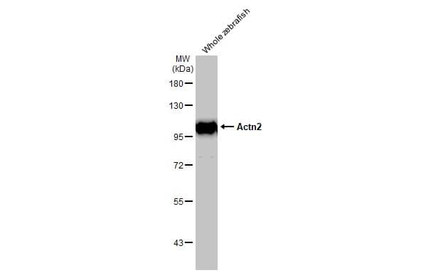 Western Blot: Alpha Actinin 2 Antibody [NBP1-32462] - Whole zebrafish extract (30 ug) was separated by 7.5% SDS-PAGE, and the membrane was blotted with Alpha Actinin 2 antibody [N1N3] (NBP1-32462) diluted at 1:1000. The HRP-conjugated anti-rabbit IgG antibody  was used to detect the primary antibody.