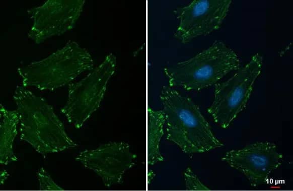 Immunocytochemistry/ Immunofluorescence: Alpha Actinin 2 Antibody [NBP1-32462] - Alpha Actinin 2 antibody [N1N3] detects Alpha Actinin 2 protein at cytoskeleton by immunofluorescent analysis.Sample: HeLa cells were fixed in ice-cold MeOH for 5 min.Green: Alpha Actinin 2 stained by Alpha Actinin 2 antibody [N1N3] (NBP1-32462) diluted at 1:500.Blue: Fluoroshield with DAPI .