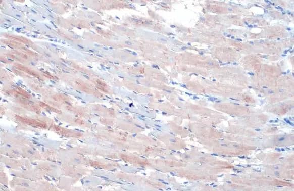 Immunohistochemistry-Paraffin: Alpha Actinin 2 Antibody [NBP1-32462] - Alpha Actinin 2 antibody [N1N3] detects Alpha Actinin 2 protein at cytoplasm by immunohistochemical analysis.Sample: Paraffin-embedded rat heart.Alpha Actinin 2 stained by Alpha Actinin 2 antibody [N1N3] (NBP1-32462) diluted at 1:500.Antigen Retrieval: Citrate buffer, pH 6.0, 15 min