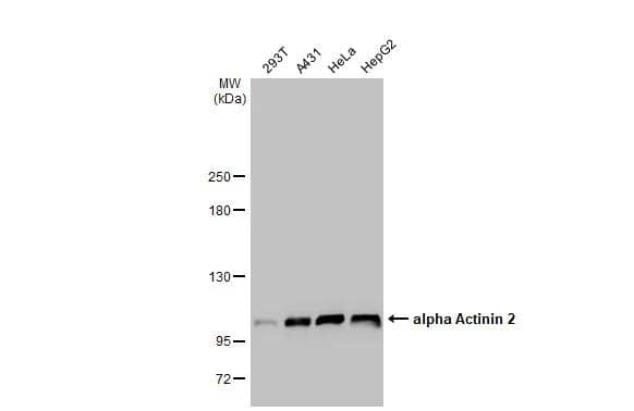 Various whole cell extracts (30 ug) were separated by 5% SDS-PAGE, and the membrane was blotted with alpha Actinin 2 antibody [N1N3] (NBP1-32462) diluted at 1:1000. The HRP-conjugated anti-rabbit IgG antibody  was used to detect the primary antibody. 
