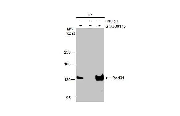 Immunoprecipitation of Rad21 protein from HeLa whole cell extract using 5 ug of Rad21 antibody [HL2171] (NBP3-25619).Western blot analysis was performed using Rad21 antibody [HL2171] (NBP3-25619).EasyBlot HRP-conjugated anti rabbit IgG antibody . 