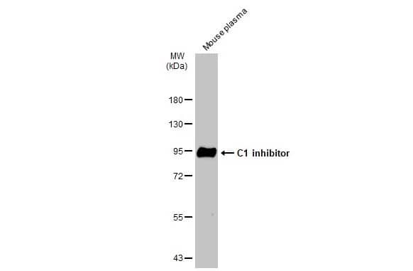 Western Blot: Serpin G1/C1 Inhibitor Antibody [NBP1-32478] - Mouse plasma (50 ug) was separated by 7.5% SDS-PAGE, and the membrane was blotted with Serpin G1/C1 Inhibitor antibody [N1C3] (NBP1-32478) diluted at 1:3000. The HRP-conjugated anti-rabbit IgG antibody  was used to detect the primary antibody.