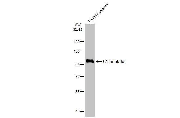 Western Blot: Serpin G1/C1 Inhibitor Antibody [NBP1-32478] - Human plasma (30 ug) was separated by 7.5% SDS-PAGE, and the membrane was blotted with Serpin G1/C1 Inhibitor antibody [N1C3] (NBP1-32478) diluted at 1:15000. The HRP-conjugated anti-rabbit IgG antibody  was used to detect the primary antibody.