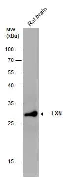 Western Blot: Latexin Antibody [NBP1-32525] - Rat tissue extract (50 ug) was separated by 12% SDS-PAGE, and the membrane was blotted with Latexin antibody [N1C3] (NBP1-32525) diluted at 1:1000. The HRP-conjugated anti-rabbit IgG antibody  was used to detect the primary antibody.