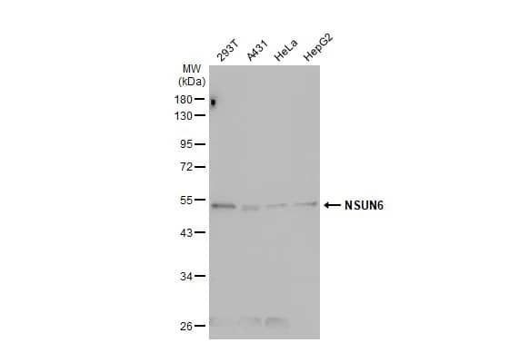 Western Blot: NSUN6 Antibody [NBP1-32531] - Various whole cell extracts (30 ug) were separated by 10% SDS-PAGE, and the membrane was blotted with NSUN6 antibody [N3C3] (NBP1-32531) diluted at 1:1000. The HRP-conjugated anti-rabbit IgG antibody  was used to detect the primary antibody.