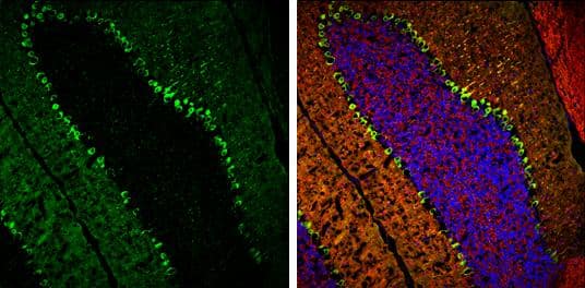 PKC gamma antibody detects PKC gamma protein expression by immunohistochemical analysis.Sample: Frozen-sectioned adult mouse cerebellum. Green: PKC gamma protein stained by PKC gamma antibody (NBP1-32535) diluted at 1:250.Red: beta Tubulin 3/ TUJ1, stained by beta Tubulin 3/ TUJ1 antibody [GT11710] diluted at 1:500.Blue: Fluoroshield with DAPI . 