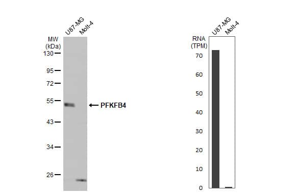 Various whole cell extracts (30 ug) were separated by 10% SDS-PAGE, and the membrane was blotted with PFKFB4 antibody (NBP1-32538) diluted at 1:1000. The HRP-conjugated anti-rabbit IgG antibody was used to detect the primary antibody. Corresponding RNA expression data for the same cell lines are based on Human Protein Atlas program. 