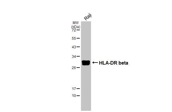 Whole cell extract (30 ug) was separated by 12% SDS-PAGE, and the membrane was blotted with HLA-DR beta antibody [N1C3] (NBP1-32553) diluted at 1:1000. The HRP-conjugated anti-rabbit IgG antibody  was used to detect the primary antibody. 