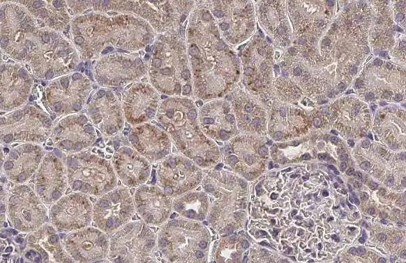 Immunohistochemistry-Paraffin MLYCD Antibody - Azide and BSA Free