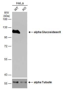 Wild-type (WT) and alpha Glucosidase 2 knockout (KO) HeLa cell extracts (30 ug) were separated by 7.5% SDS-PAGE, and the membrane was blotted with alpha Glucosidase 2 antibody [N1N2], N-term (NBP1-32554) diluted at 1:1000. The HRP-conjugated anti-rabbit IgG antibody was used to detect the primary antibody. 