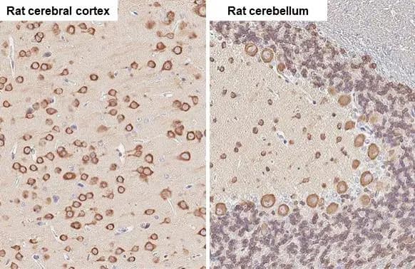 Immunohistochemistry-Paraffin: EEF1A2 Antibody [NBP1-32555] - EEF1A2 antibody [C1C3] detects EEF1A2 protein at cytoplasm by immunohistochemical analysis.Sample: Paraffin-embedded rat tissue.EEF1A2 stained by EEF1A2 antibody [C1C3] (NBP1-32555) diluted at 1:500.Antigen Retrieval: Citrate buffer, pH 6.0, 15 min