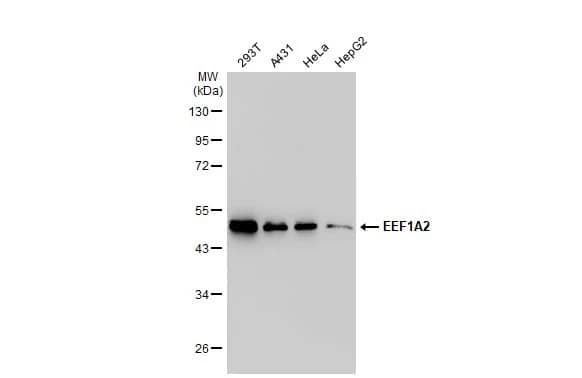 Western Blot: EEF1A2 Antibody [NBP1-32555] - Various whole cell extracts (30 ug) were separated by 10% SDS-PAGE, and the membrane was blotted with EEF1A2 antibody [C1C3] (NBP1-32555) diluted at 1:1000. The HRP-conjugated anti-rabbit IgG antibody  was used to detect the primary antibody.