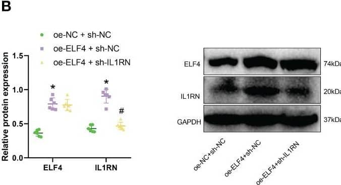 Effects of the ELF4/IL1RN axis on inflammation symptoms in mice intestines. (A) RT-qPCR was used to detect the mRNA levels of ELF4 and IL1RN in intestinal tissues of mice from each group; (B) Western blot was used to detect the protein levels of ELF4 and IL1RN in intestinal tissues of mice from each group; (C) Flow cytometry was used to detect the proportions of M1 and M2 cells in intestinal tissues of mice from each group; (D) Western blot was used to detect the protein levels of M1 marker iNOS and M2 markers Arg1 and CD163 in intestinal tissues of mice from each group; (E) The DAI scores of mice in each group were recorded; (F) H&E staining was used to evaluate colonic tissue injury in mice from each group; (G) ELISA was used to measure the levels of inflammatory factors Treml, IL-6, TNF-alpha , and IL-1 beta  in the serum of mice from each group; (H) Flow cytometry was used to detect the proportions of TH17 and Treg cells in intestinal tissues of mice from each group, as well as the TH17/Treg ratio. * indicates P < 0.05 compared with oe-NC + sh-NC, and # indicates P < 0.05 compared with oe-ELF4+sh-NC. All cell experiments were repeated three times. Image collected and cropped by CiteAb from the following open publication (//pubmed.ncbi.nlm.nih.gov/38022496), licensed under a CC-BY license. Not internally tested by Novus Biologicals.