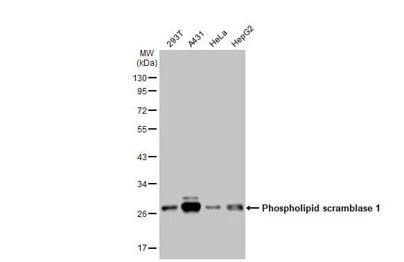 Various whole cell extracts (30 ug) were separated by 10% SDS-PAGE, and the membrane was blotted with Phospholipid Scramblase 1/PLSCR1 antibody [N1C3] (NBP1-32588) diluted at 1:1000. The HRP-conjugated anti-rabbit IgG antibody was used to detect the primary antibody. 