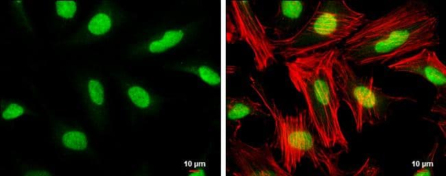TFIIB antibody [N1C3] detects TFIIB protein at nucleus by immunofluorescent analysis.Sample: HeLa cells were fixed in 4% paraformaldehyde at RT for 15 min.Green: TFIIB stained by TFIIB antibody [N1C3] (NBP1-32622) diluted at 1:1000.Red: phalloidin, a cytoskeleton marker, diluted at 1:100.Scale bar= 10um. 