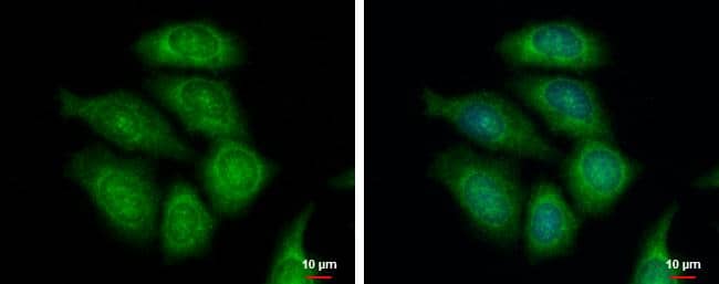 FASTKD1 antibody [C1C3] detects FASTKD1 protein at cytoplasm by immunofluorescent analysis.Sample: MCF-7 cells were fixed in ice-cold MeOH for 5 min.Green: FASTKD1 protein stained by FASTKD1 antibody [C1C3] (NBP1-32639) diluted at 1:500.Blue: Hoechst 33342 staining. 