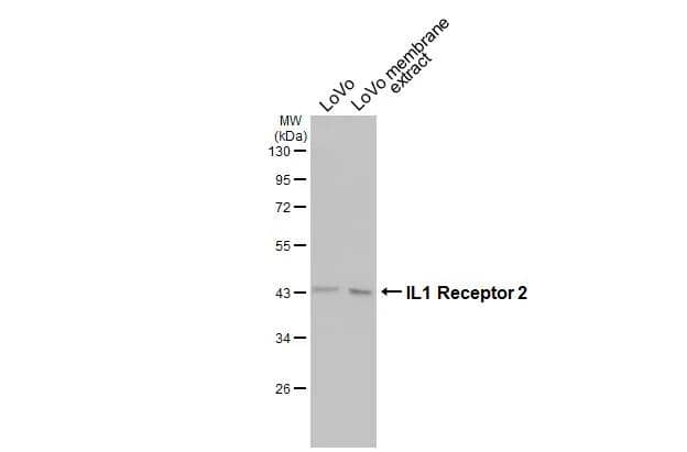 LoVo whole cell and membrane extracts (30 ug) were separated by 10% SDS-PAGE, and the membrane was blotted with IL1 Receptor 2 antibody [N3C3] (NBP1-32681) diluted at 1:1000. The HRP-conjugated anti-rabbit IgG antibody  was used to detect the primary antibody. 