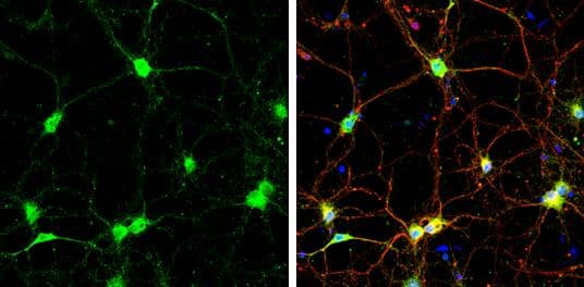 SNAP23 antibody detects SNAP23 protein at cell body and synaptic vesicles by immunofluorescent analysis.Sample: DIV9 rat E18 primary cortical neurons were fixed in 4% paraformaldehyde at RT for 15 min.Green: SNAP23 protein stained by SNAP23 antibody (NBP1-32694) diluted at 1:500.Red: beta Tubulin 3/ Tuj1, a neuron cell marker, stained by beta Tubulin 3/ Tuj1 antibody [GT11710] diluted at 1:500.Blue: Fluoroshield with DAPI . 