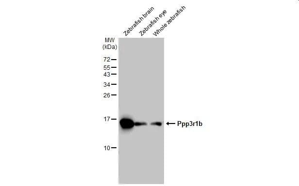 Various tissue extracts (30 ug) were separated by 15% SDS-PAGE, and the membrane was blotted with Calcineurin B antibody (NBP1-32720) diluted at 1:1000. The HRP-conjugated anti-rabbit IgG antibody was used to detect the primary antibody. 