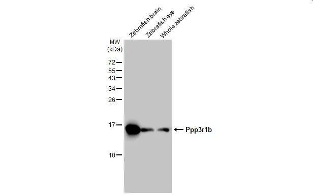 Various tissue extracts (30 ug) were separated by 15% SDS-PAGE, and the membrane was blotted with Calcineurin B antibody (NBP1-32720) diluted at 1:1000. The HRP-conjugated anti-rabbit IgG antibody  was used to detect the primary antibody. 