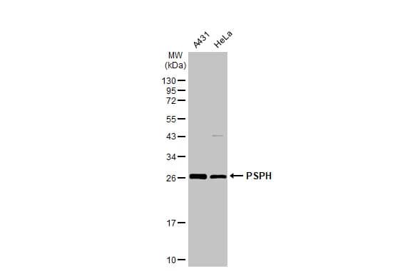 Western Blot: PSPHL Antibody [NBP1-32723] - Various whole cell extracts (30 ug) were separated by 12% SDS-PAGE, and the membrane was blotted with PSPHL antibody (NBP1-32723) diluted at 1:1000. The HRP-conjugated anti-rabbit IgG antibody  was used to detect the primary antibody.