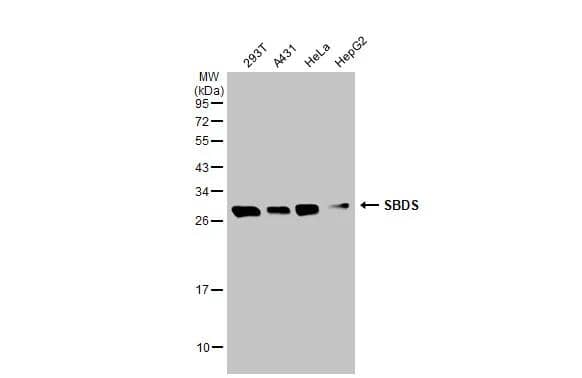 Western Blot Ribosome maturation protein SBDS Antibody - BSA Free