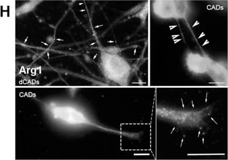 Immunocytochemistry/ Immunofluorescence: Arginase 1/ARG1/liver Arginase Antibody - BSA Free [NBP1-32731] - Validation of the LCM/MS data from cellular protrusions using microscopy. Immunofluorescence (IF) of proteins identified by LCM/MS (A–D) “expected” or (E–H) “not expected” to be within protrusions based on their known functions/localizations. (A) Cd47 & (B) Anxa2 are found in both hCAD/dCAD protrusions. (C) Tenm2 is found within hCAD protrusions & (D) Cobl in GCs. Interestingly, (E) Grk5 was observed in hCAD protrusions; (F) Hist1h3b protein in hCAD protrusions & GCs (G) Hspa1b in dCAD protrusions & TNTs & (H) Arg1 in dCAD protrusions, GCs, & TNTs. White arrows/arrowheads show punctates within dCAD/hCAD protrusions & GCs or within TNTs, respectively. Scale bars = 10 μm. IF of all 8 proteins corroborate the LCM/MS protein identification for each subtypes of protrusions. (I) 1198 unique proteins were identified by LCM/MS to be in protrusions & 169 were found to be exclusive to protrusions. 904 of the 1198 proteins found in protrusions & 87 out of 169 exclusive proteins had images in the HPA Subcell database. IF images for the proteins identified by LCM/MS in protrusions, present in the HPA Subcell database, were observed & catalogued as being observed or not in protrusions (Figure S2). On average 4.7% of proteins are found in protrusions in the HPA database, 13.6% are found in our LCM isolated protrusions & 23% were found in the “exclusive” LCM protrusions. The fold enrichment increases by 2.9% or 4.8% when we looked at proteins identified by LCM/MS in protrusions or exclusive to protrusions, respectively. Image collected & cropped by CiteAb from the following publication (//pubmed.ncbi.nlm.nih.gov/30866487), licensed under a CC-BY license. Not internally tested by Novus Biologicals.