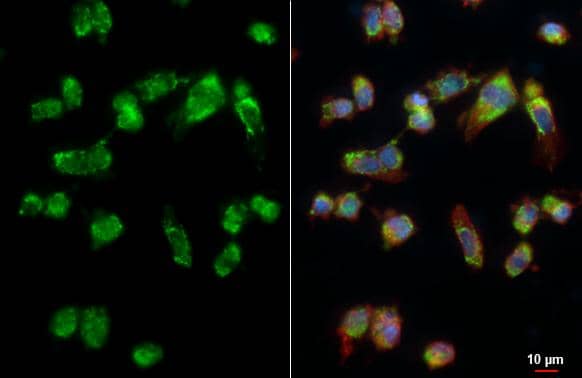 Immunocytochemistry/ Immunofluorescence PEX26 Antibody - BSA Free