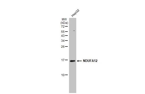 Western Blot: NDUFA12 Antibody [NBP1-32745] - Whole cell extract (30 ug) was separated by 15% SDS-PAGE, and the membrane was blotted with NDUFA12 antibody [N1C3] (NBP1-32745) diluted at 1:1000. The HRP-conjugated anti-rabbit IgG antibody  was used to detect the primary antibody.