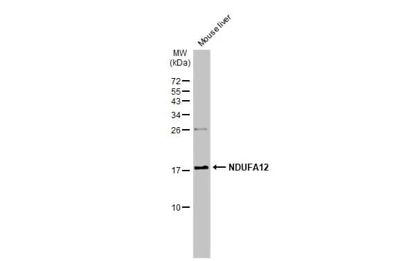 Western Blot: NDUFA12 Antibody [NBP1-32745] - Mouse tissue extract (50 ug) was separated by 15% SDS-PAGE, and the membrane was blotted with NDUFA12 antibody [N1C3] (NBP1-32745) diluted at 1:1000. The HRP-conjugated anti-rabbit IgG antibody  was used to detect the primary antibody.