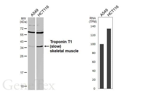 Various whole cell extracts (30 ug) were separated by 12% SDS-PAGE, and the membrane was blotted with Troponin T1 (slow) skeletal muscle antibody (NBP1-32748) diluted at 1:1000. The HRP-conjugated anti-rabbit IgG antibody  was used to detect the primary antibod, and the signal was developed with Trident femto Western HRP Substrate. Corresponding RNA expression data are based on Human Protein Atlas program. 