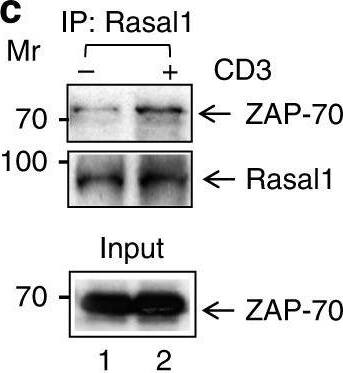 Western Blot: RASAL1 Antibody [NBP1-32776] - Rasal1 binds to the immune cell tyrosine kinase ZAP-70. a Proximity ligation assay (PLA) of Rasal1 & ZAP-70 in Jurkat T-cells stained with DAPI, anti-Rasal1, & anti-ZAP-70. Positive PLA signal (fluorescent dots) indicates a distance of 30–40 nm between Rasal1 & ZAP-70 in anti-CD3-activated T cells, indicating their close proximity (n = 2). b Anti-Rasal1 co-precipitates ZAP-70 from primary mouse T cells. Lane 1–2 loading controls, lanes 3-4: anti-Rasal1 IP: lanes 2 & 4. Cells were stimulated with anti-CD3 ligation for 5 min vs IgG control ligation in lanes 1 & 3. c Anti-Rasal1 co-precipitates ZAP-70 from transfected Jurkat T cells. Lanes 1: nonligated (i.e., IgG); lane 2: anti-CD3 ligated T cells for 5 min. Lower panel shows similar level of ZAP-70 expression in lysates of (n = 2) Image collected & cropped by CiteAb from the following publication (//pubmed.ncbi.nlm.nih.gov/31641113), licensed under a CC-BY license. Not internally tested by Novus Biologicals.